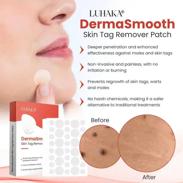 Smooth Skin Tag Patches
